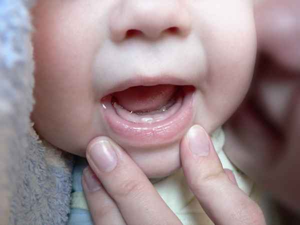 Появление первого зуба Первые зубки 